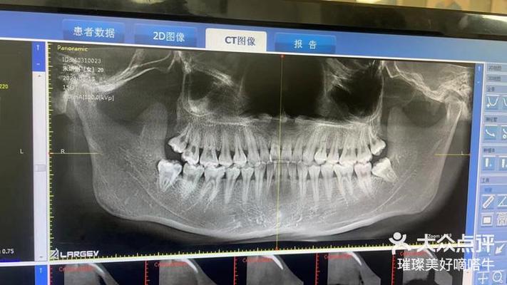 口腔正畸X光片有何关键作用?-图1 口腔正畸X光片有何关键作用?-图1