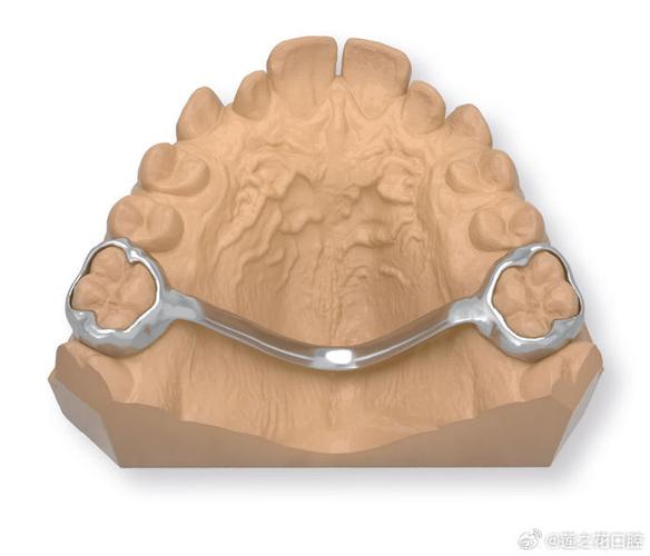 正畸科TPA弯制-图1