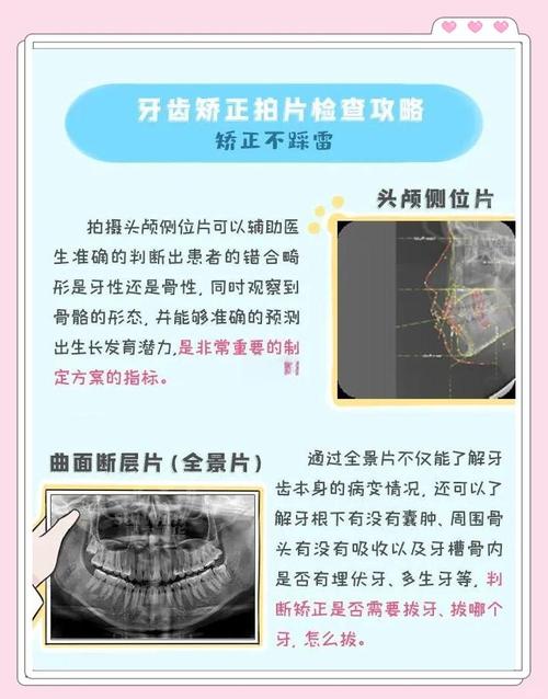 正畸为何要拍照?这些照片到底有啥用?-图1 正畸为何要拍照?这些照片到底有啥用?-图1
