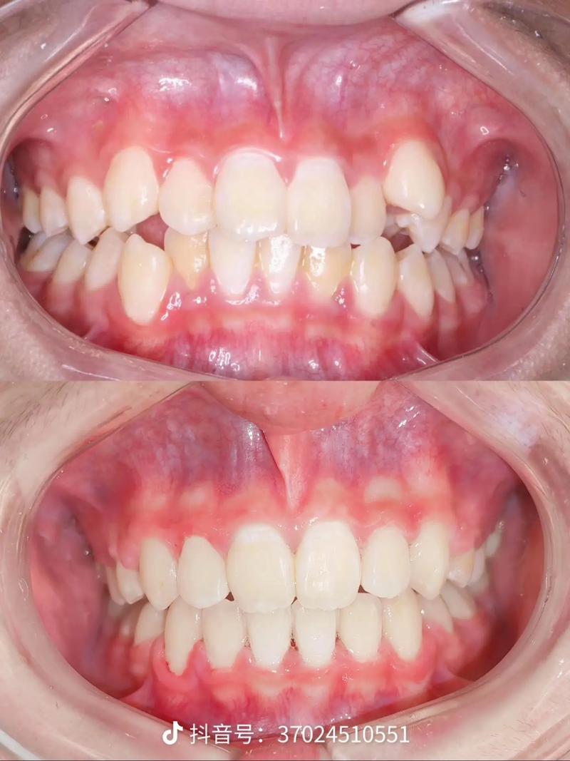 河北和平医院正畸-图3
