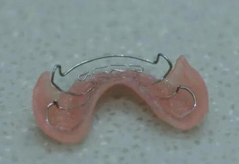 正畸前牙颌垫图片-图3 正畸前牙颌垫图片-图3