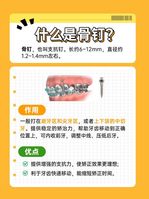 正畸支抗钉大小怎么选才合适？-图1