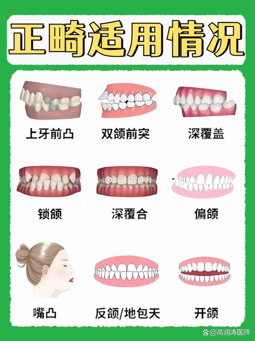 哪种正畸保护蜡好-图1 哪种正畸保护蜡好-图1