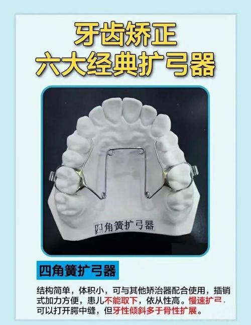 问号弓是什么正畸-图1