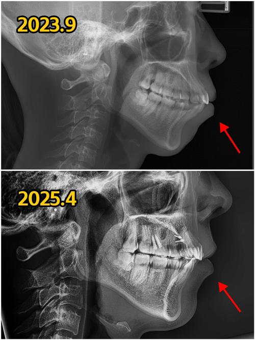 天津巿正畸哪儿好-图1 天津巿正畸哪儿好-图1