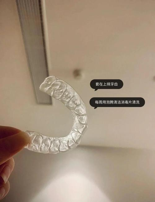 正畸垫咬合用什么材料？不同类型如何选择更合适？-图2