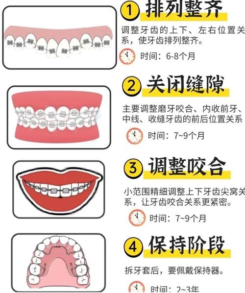 正畸分牙过程是怎样的？为何分牙是矫正的关键一步？-图1