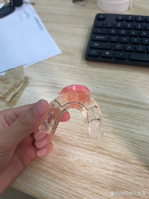 口腔正畸颌垫制作的关键步骤有哪些？材料选择与注意事项如何？-图1