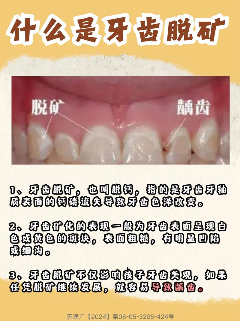 正畸白斑如何治疗-图1