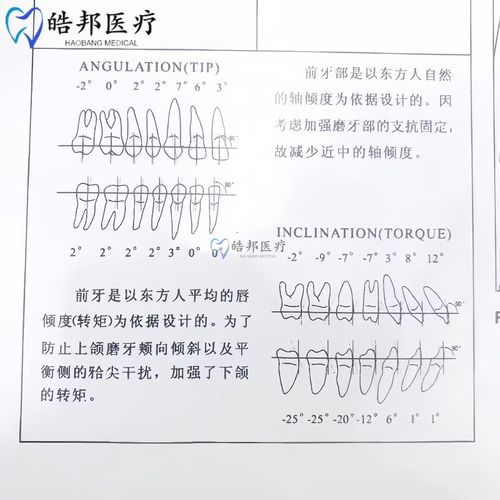 正畸弓丝左右滑动,原因是什么?影响矫正效果吗?-图3 正畸弓丝左右滑动,原因是什么?影响矫正效果吗?-图3