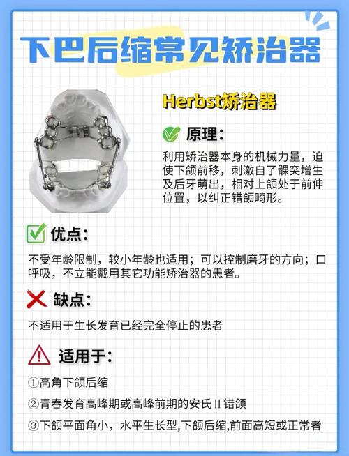 正畸上颌腭珠作用-图1