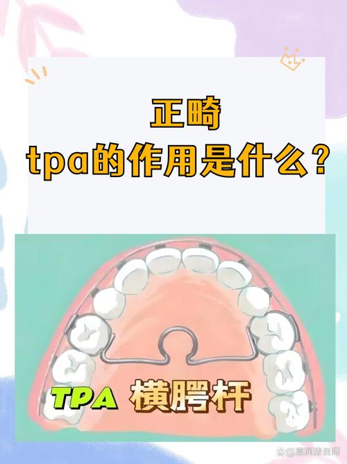 正畸上颌腭珠作用-图2