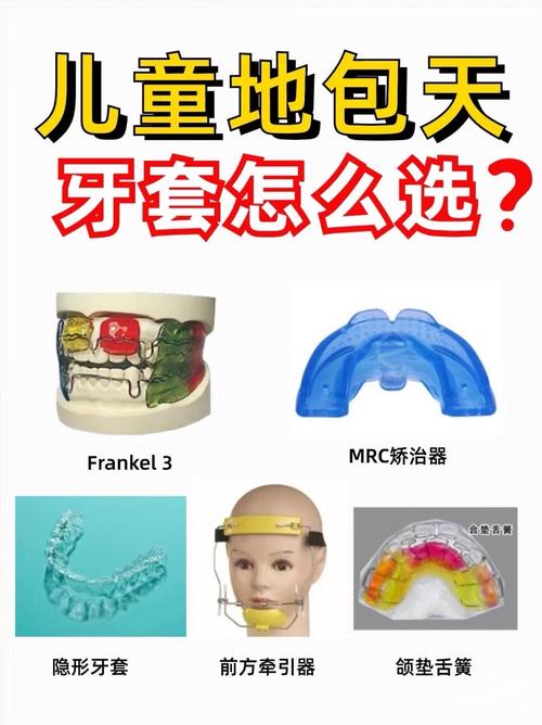牙齿正畸牙套种类有哪些?如何挑选最适合自己的?-图3 牙齿正畸牙套种类有哪些?如何挑选最适合自己的?-图3