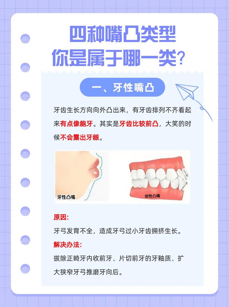 如何判定正畸骨性？关键临床指标与方法有哪些？-图3