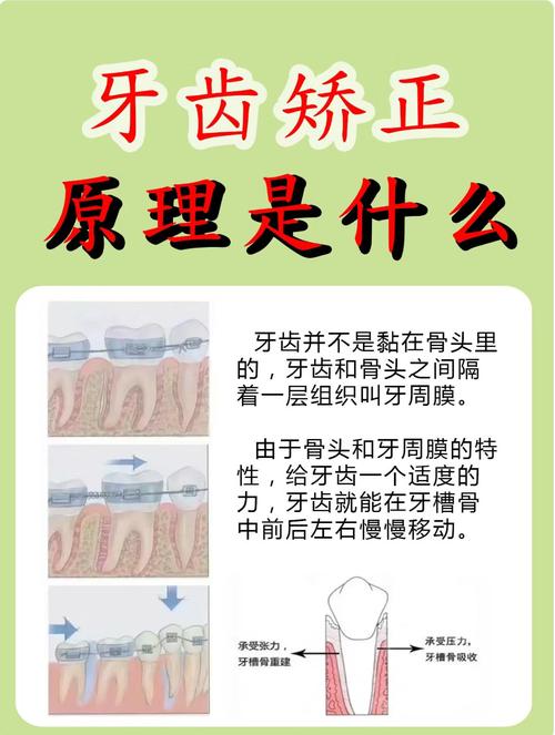 牙齿正畸科普知识-图2