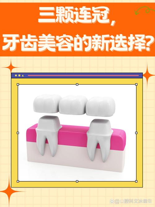 正畸美容冠是什么？矫正与美容的牙齿新方案？-图1