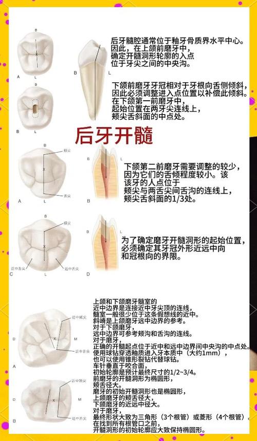 口腔正畸澳丝原理-图3