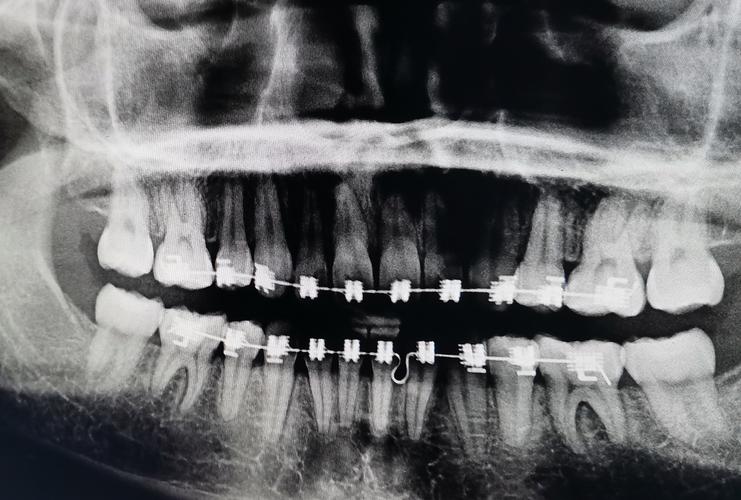 深圳美奥口腔正畸-图1 深圳美奥口腔正畸-图1