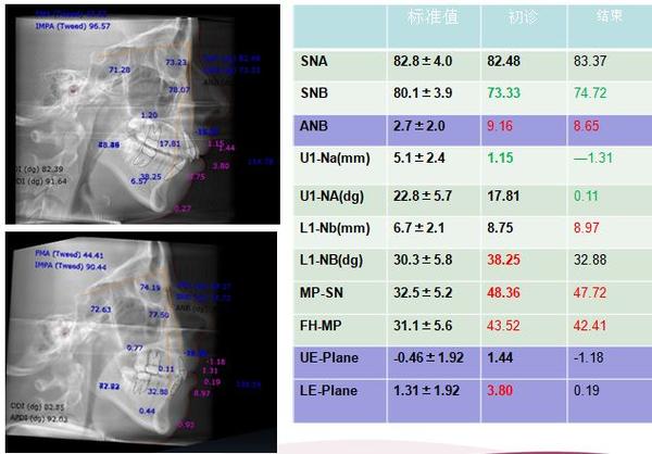 正畸头颅侧位软件-图2 正畸头颅侧位软件-图2