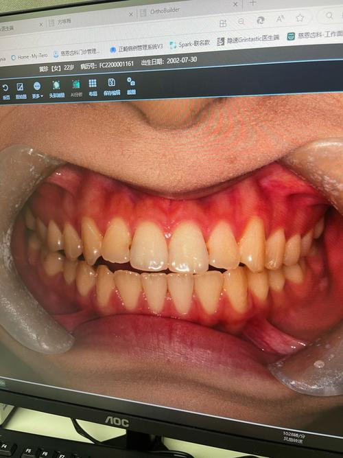 正畸摄影照片翻转-图2