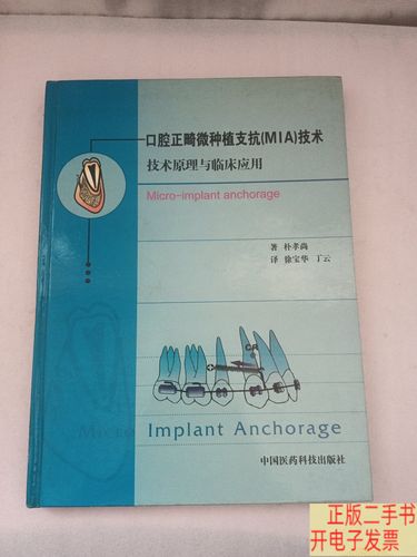 正畸mia的原理-图3