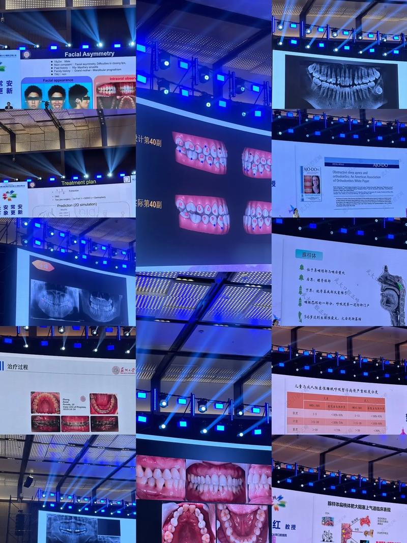 国际著名正畸杂志聚焦哪些正畸前沿研究方向？-图2