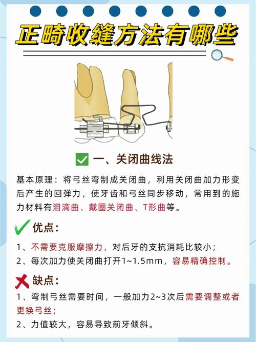 正畸牙齿加力原理-图3