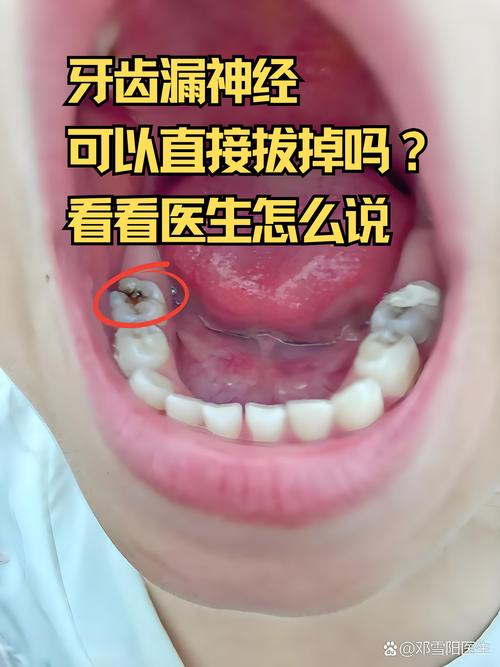 正畸牙齿连着神经-图1 正畸牙齿连着神经-图1