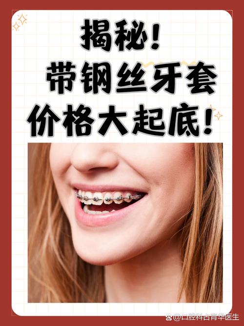 牙齿正畸钢丝型号-图2