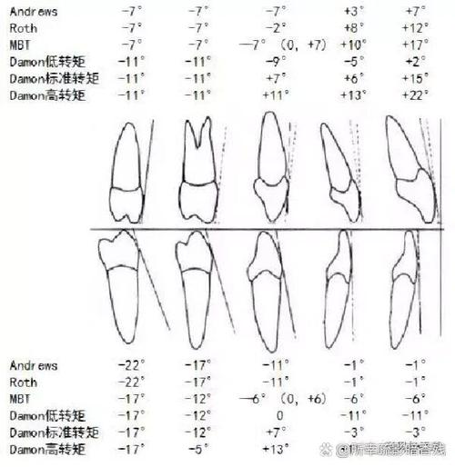 正畸标准转矩角度的标准是什么？临床应用有何关键？-图1