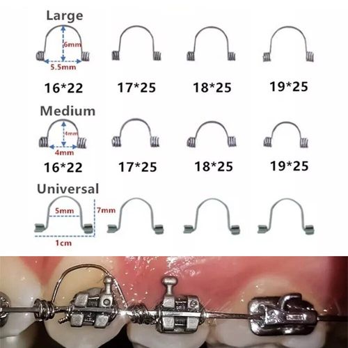 正畸标准转矩角度的标准是什么？临床应用有何关键？-图2