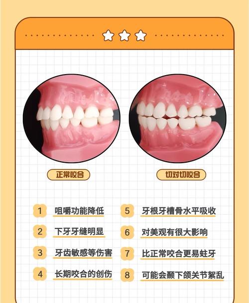 正畸咬合关系描述-图3