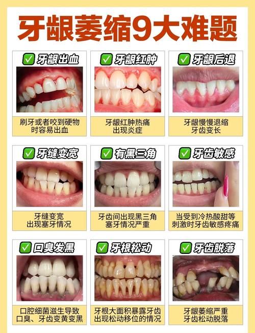 牙龈萎缩原因正畸-图1