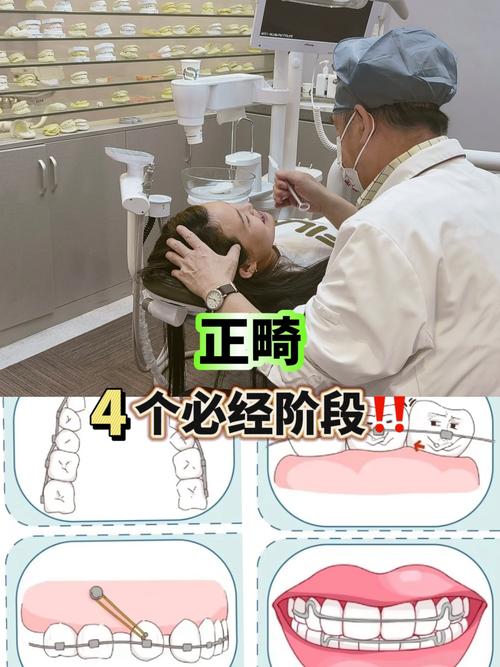 正畸进修一般需要多长时间？-图3