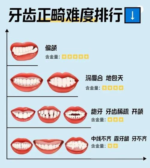 口腔正畸知识科普，这些疑问你想知道吗？-图2