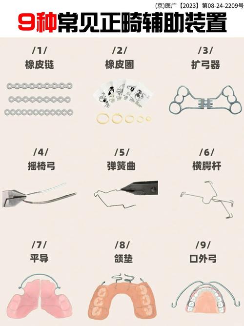 begg正畸辅弓-图1