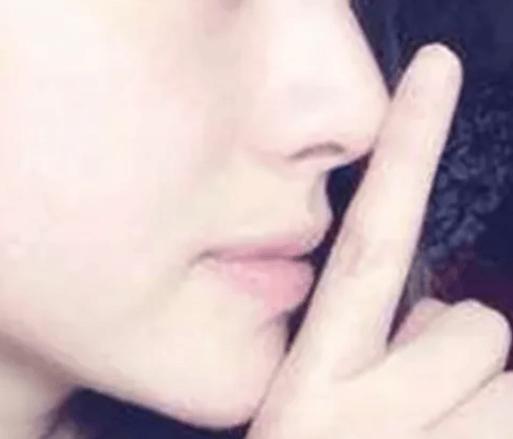 正畸角度测量标准-图3