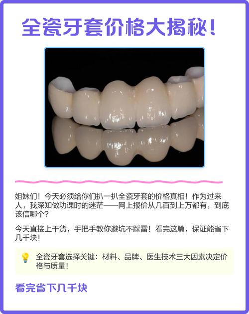 陶瓷托槽牙齿正畸价格为何差异大？影响因素有哪些？-图2