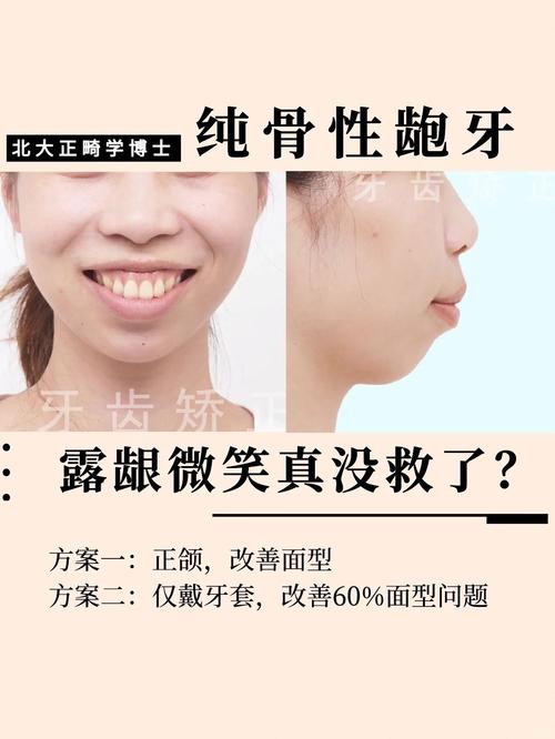 深圳北大正畸失败，责任究竟谁来担？-图1