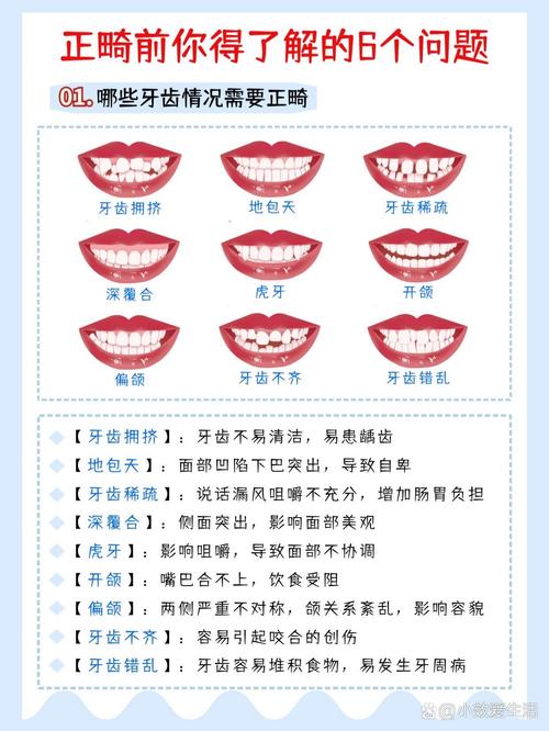 口腔正畸需掌握哪些核心内容？-图1