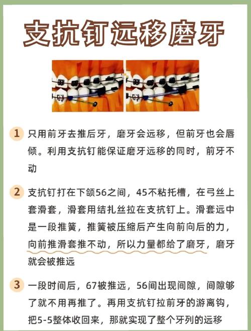 磨牙该怎么正畸？关键方法与步骤解析-图1