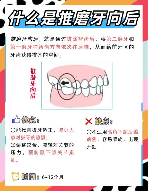 磨牙该怎么正畸？关键方法与步骤解析-图2