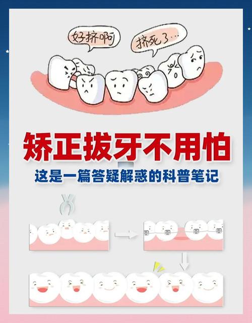 正畸 拔牙的好处-图3