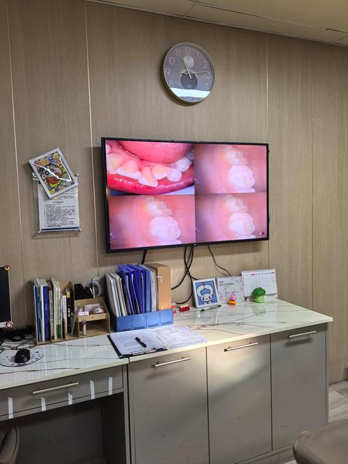 成人正畸牙齿清洁，如何做到有效清洁？-图3