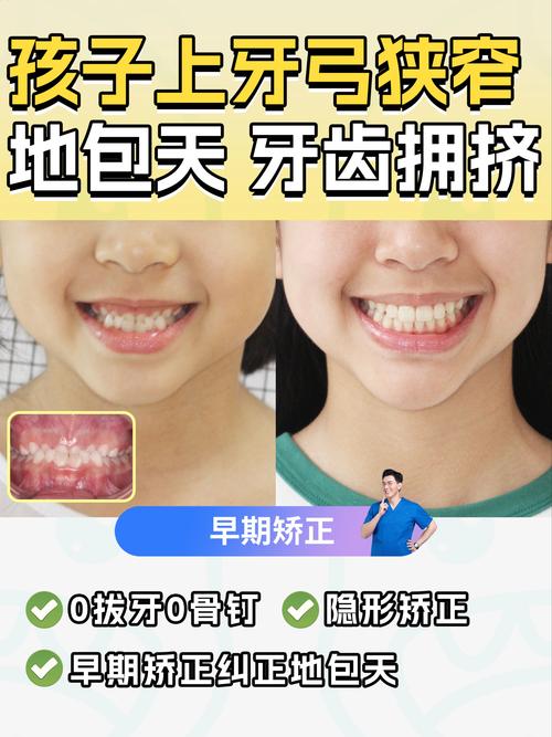 正畸时有乳牙,会影响牙齿矫正效果吗?-图3 正畸时有乳牙,会影响牙齿矫正效果吗?-图3