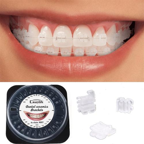 正畸陶瓷还是透明-图1 正畸陶瓷还是透明-图1