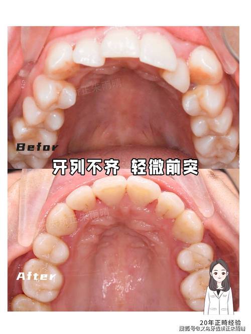 正畸失败案例退钱-图3