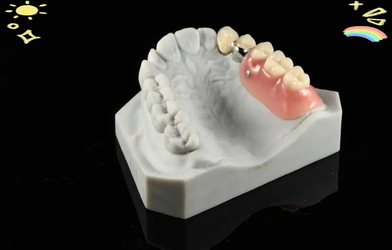 牙齿正畸牙齿附件-图1 牙齿正畸牙齿附件-图1