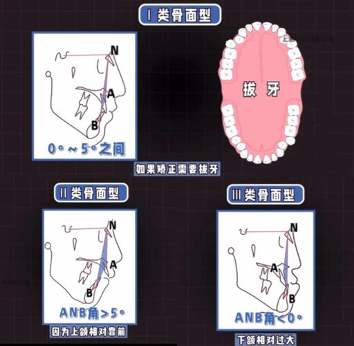 正畸治疗系统一般包括哪些主要组成部分和功能模块？-图1