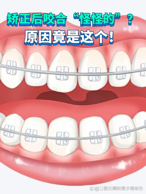 正畸调整咬合失败-图1